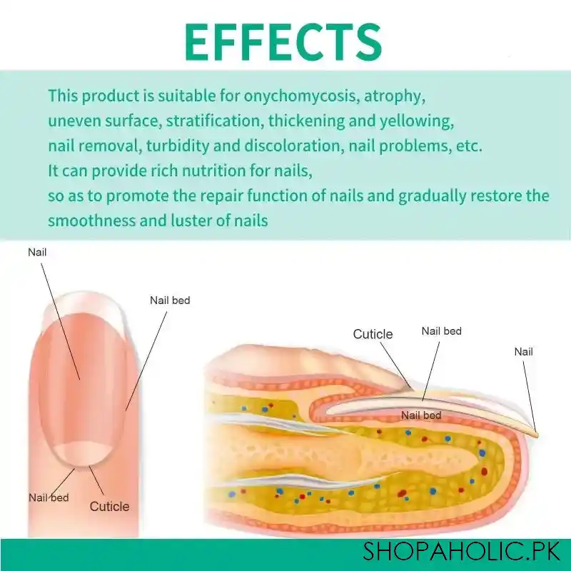 nail fungus solution image2