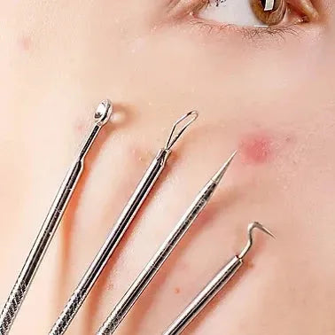 4 in 1 multifunctional acne needles image3