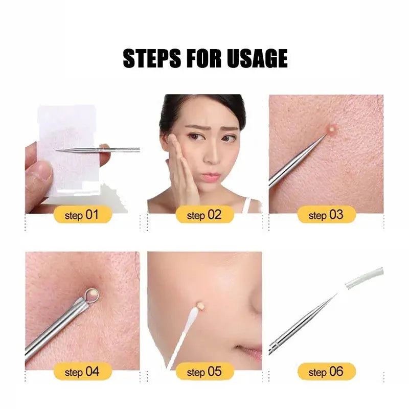 4 in 1 multifunctional acne needles image4