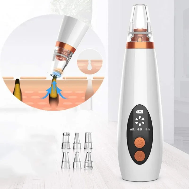 6 in 1 rechargeable blackheads removing device image5