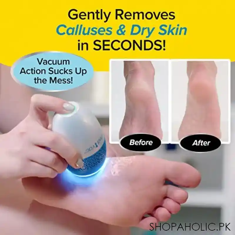 pedi vac callus remover image3