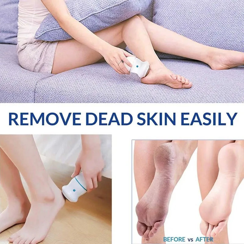 rechargeable find back callus remover with built in vacuum foot grinder machine hard crack cleaning image2