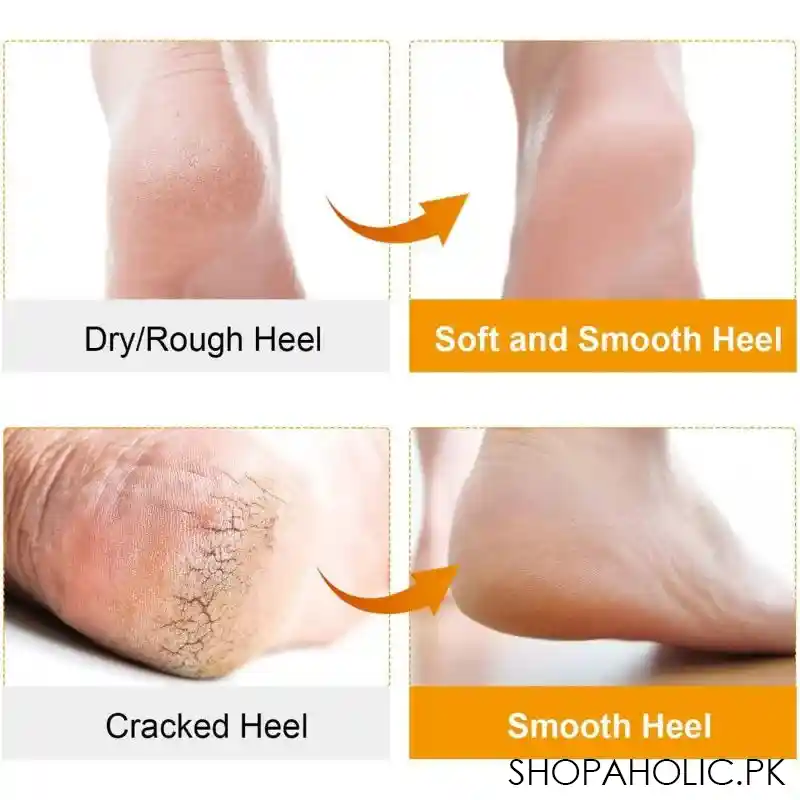 silicone foot care protector for relieve dry cracked heels and feet image4