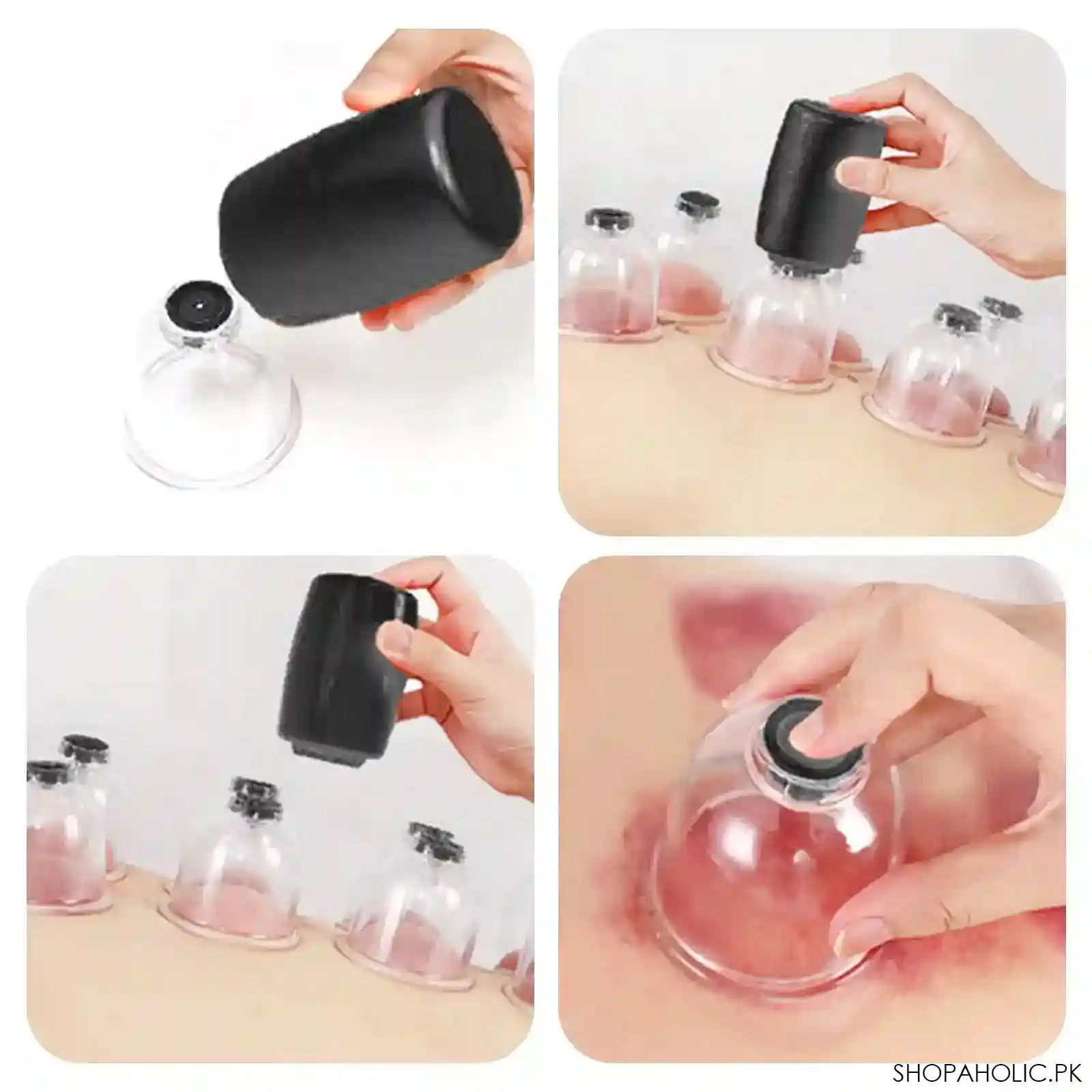 smart cupping device image2